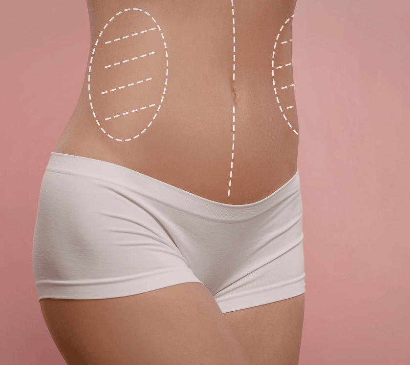 Body Contouring